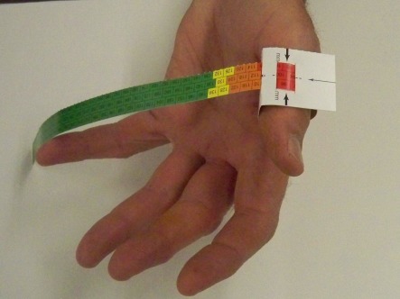 MUAC bracelet around thumb